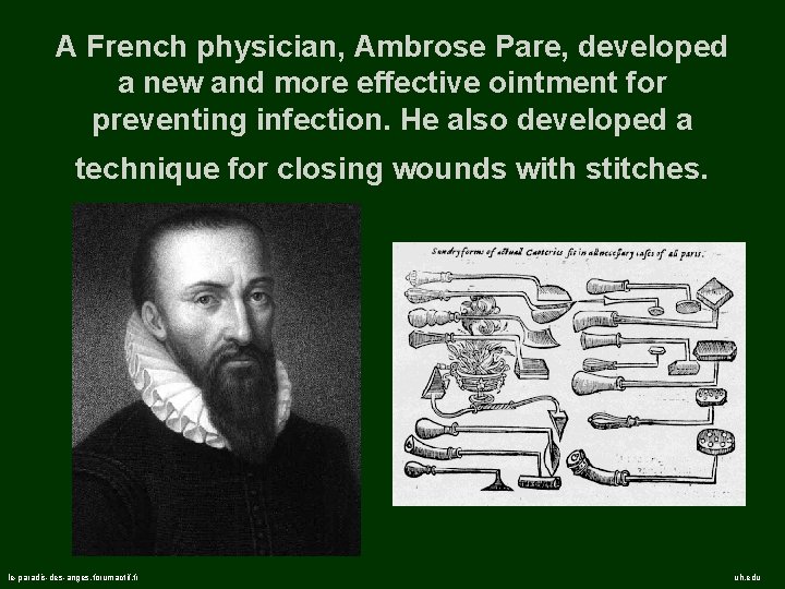 A French physician, Ambrose Pare, developed a new and more effective ointment for preventing