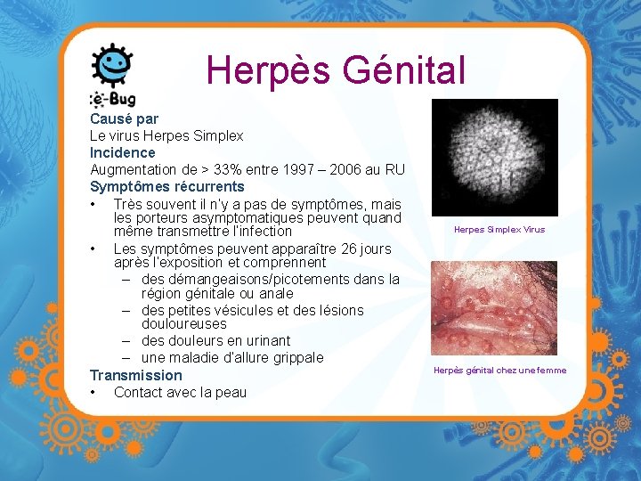 Herpès Génital Causé par Le virus Herpes Simplex Incidence Augmentation de > 33% entre