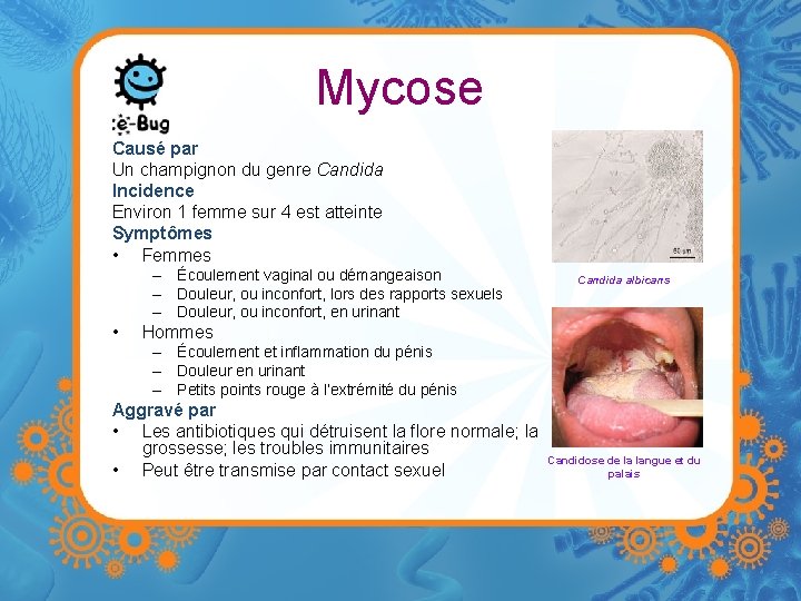 Mycose Causé par Un champignon du genre Candida Incidence Environ 1 femme sur 4