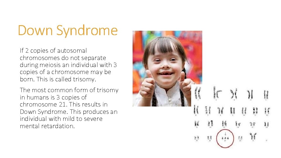 Down Syndrome If 2 copies of autosomal chromosomes do not separate during meiosis an Down Syndrome If 2 copies of autosomal chromosomes do not separate during meiosis an
