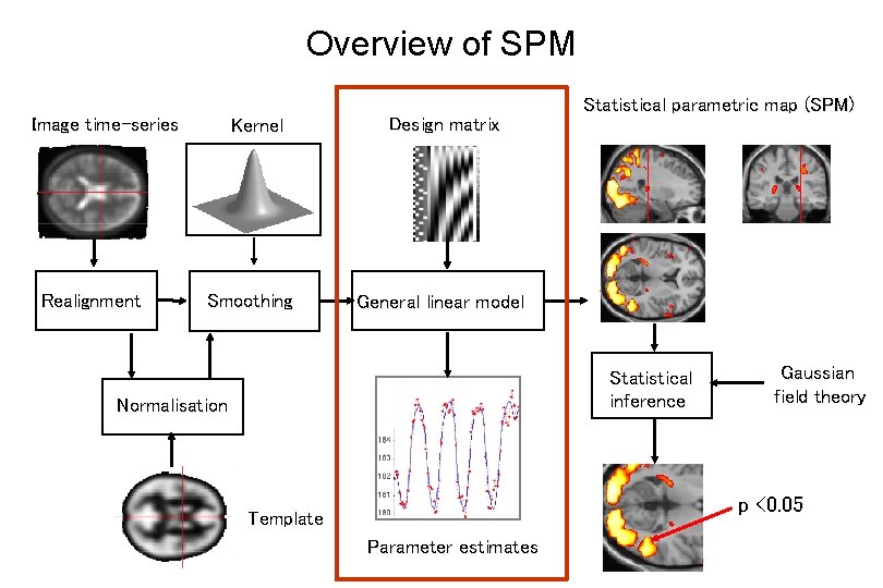 Overview of SPM Image time-series Realignment Kernel Smoothing Design matrix Statistical parametric map (SPM)