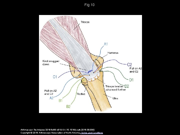 Fig 10 Arthroscopy Techniques 2019 8 e 85 -e 91 DOI: (10. 1016/j. eats.