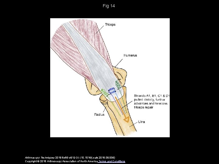 Fig 14 Arthroscopy Techniques 2019 8 e 85 -e 91 DOI: (10. 1016/j. eats.