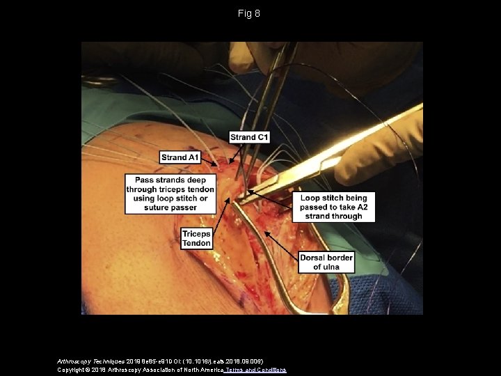 Fig 8 Arthroscopy Techniques 2019 8 e 85 -e 91 DOI: (10. 1016/j. eats.