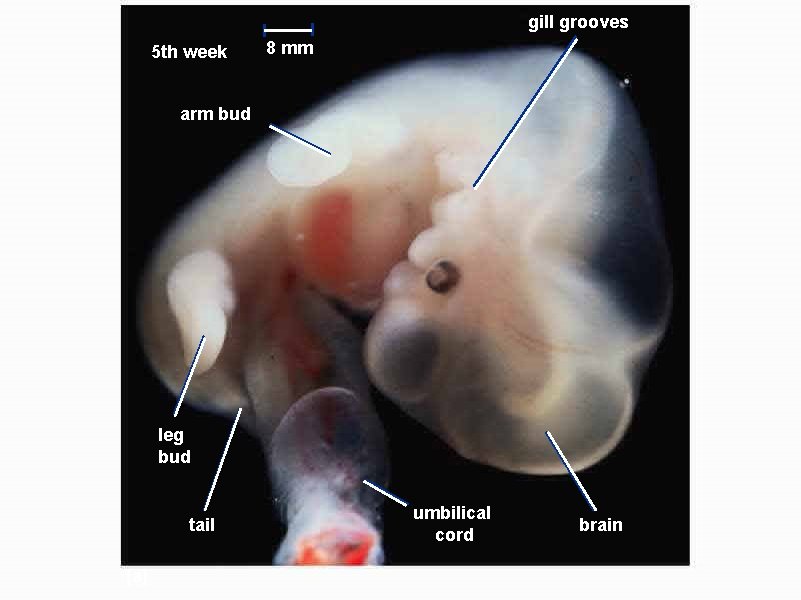 gill grooves 5 th week 8 mm arm bud leg bud tail (a) umbilical