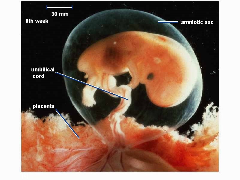 30 mm 8 th week umbilical cord placenta (c) amniotic sac 