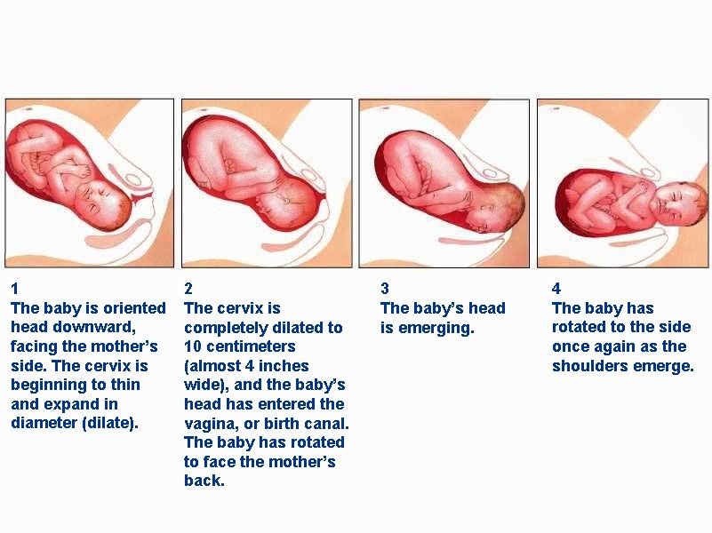 1 The baby is oriented head downward, facing the mother’s side. The cervix is