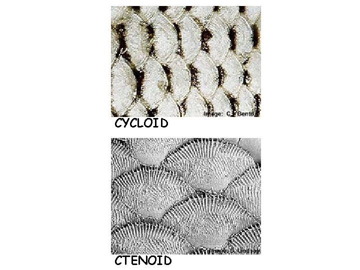 CYCLOID CTENOID 