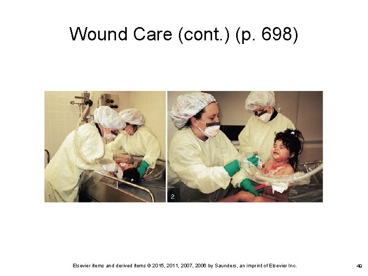 Wound Care (cont. ) (p. 698) Elsevier items and derived items © 2015, 2011,