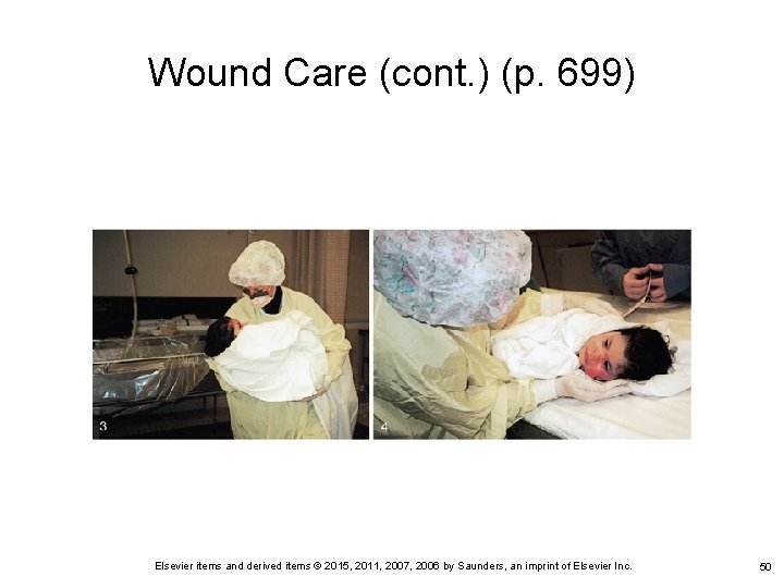 Wound Care (cont. ) (p. 699) Elsevier items and derived items © 2015, 2011,