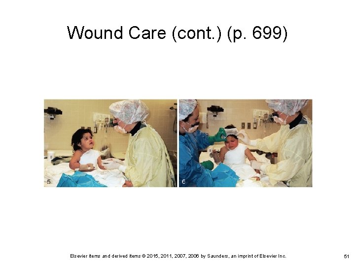 Wound Care (cont. ) (p. 699) Elsevier items and derived items © 2015, 2011,