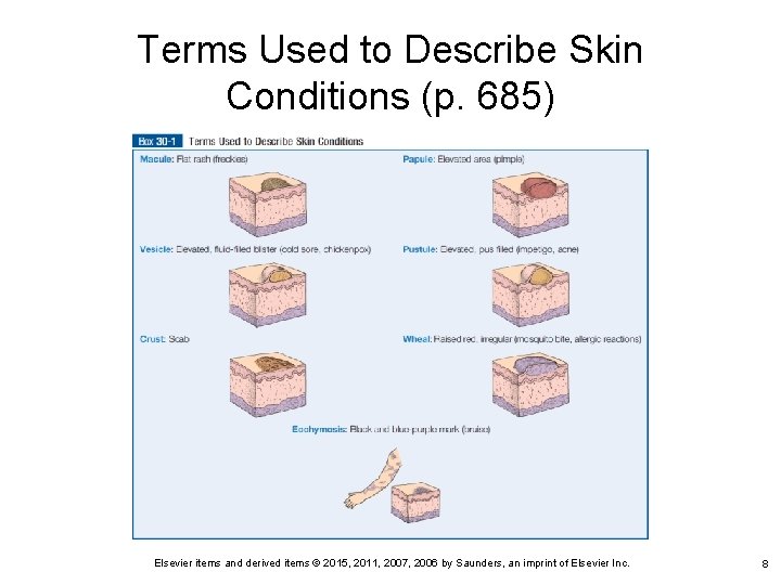 Terms Used to Describe Skin Conditions (p. 685) Elsevier items and derived items ©