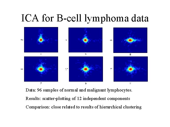 ICA for B-cell lymphoma data Data: 96 samples of normal and malignant lymphocytes. Results: