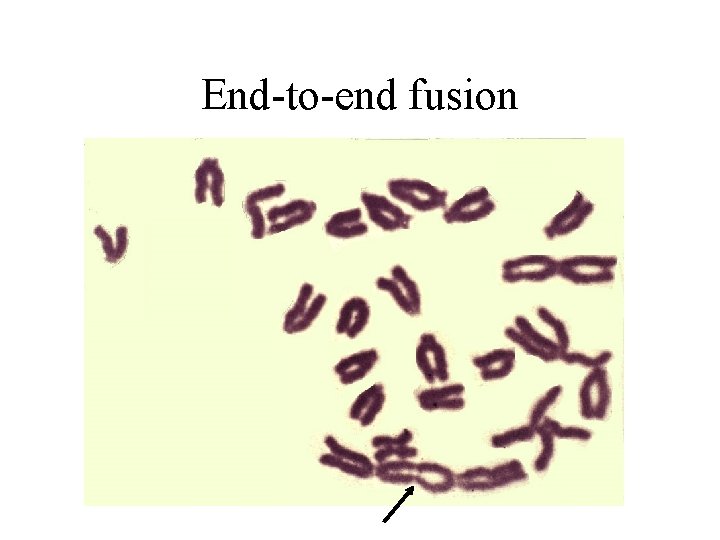 End-to-end fusion 