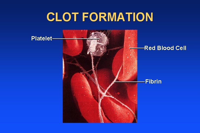 CLOT FORMATION Platelet Red Blood Cell Fibrin 