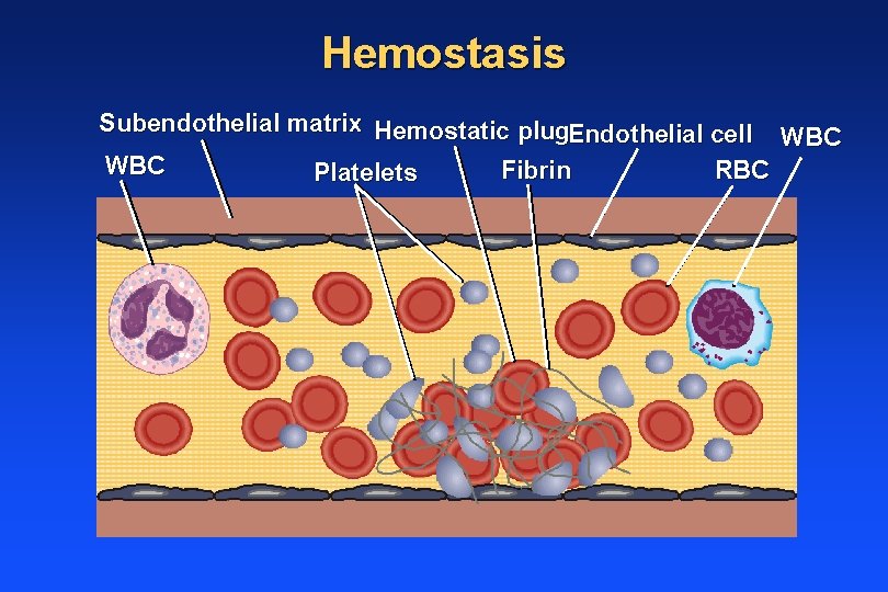 Hemostasis Subendothelial matrix Hemostatic plug. Endothelial cell WBC Fibrin RBC Platelets 