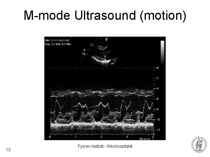 M-mode Ultrasound (motion) 13 Fysisk institutt - Rikshospitalet M-mode Ultrasound (motion) 13 Fysisk institutt - Rikshospitalet