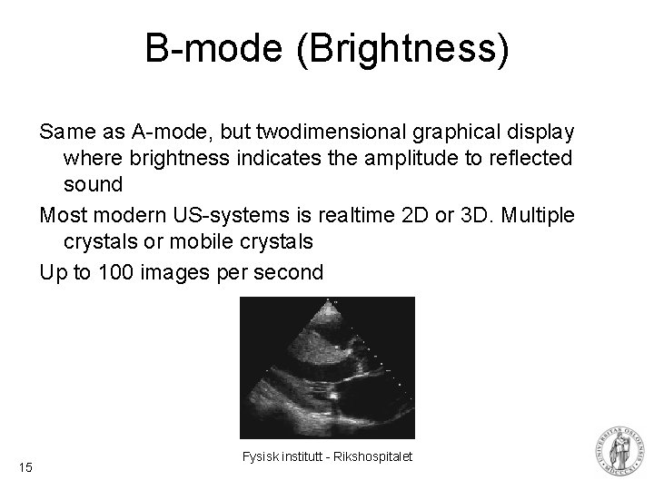 B-mode (Brightness) Same as A-mode, but twodimensional graphical display where brightness indicates the amplitude B-mode (Brightness) Same as A-mode, but twodimensional graphical display where brightness indicates the amplitude