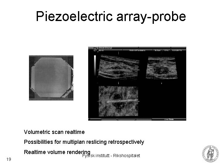 Piezoelectric array-probe Volumetric scan realtime Possibilities for multiplan reslicing retrospectively Realtime volume rendering 19