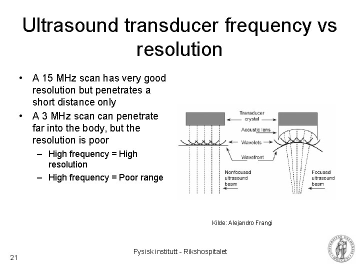 Ultrasound transducer frequency vs resolution • A 15 MHz scan has very good resolution