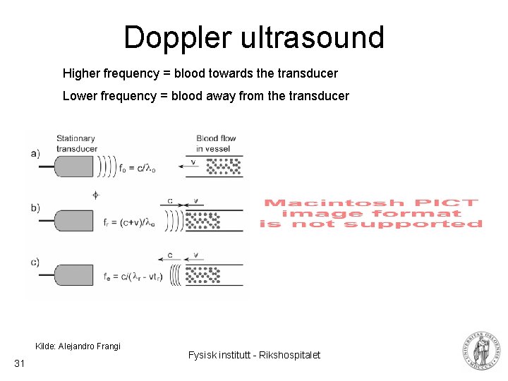Doppler ultrasound Higher frequency = blood towards the transducer Lower frequency = blood away