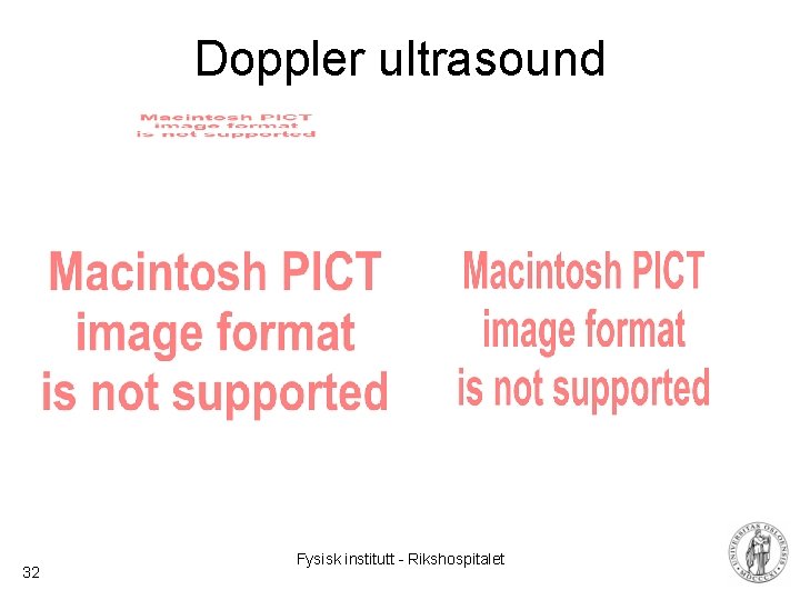 Doppler ultrasound 32 Fysisk institutt - Rikshospitalet 