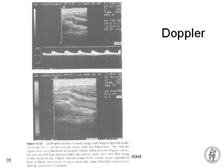 Doppler 35 Fysisk institutt - Rikshospitalet 