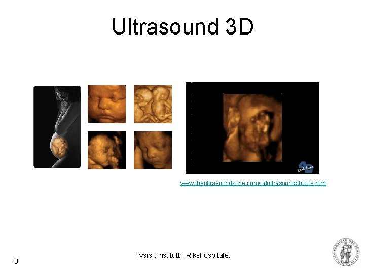 Ultrasound 3 D www. theultrasoundzone. com/3 dultrasoundphotos. html 8 Fysisk institutt - Rikshospitalet 