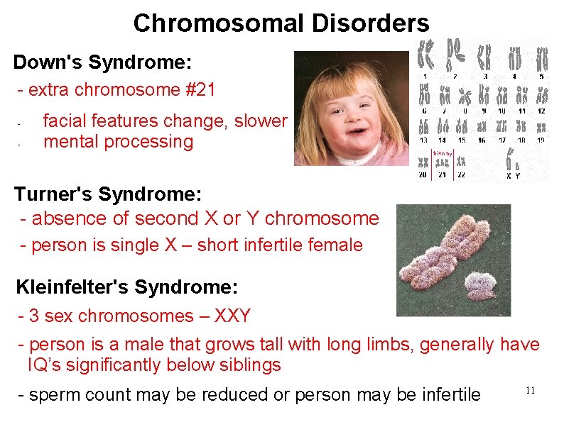  Chromosomal Disorders Down's Syndrome: - extra chromosome #21 - facial features change, slower