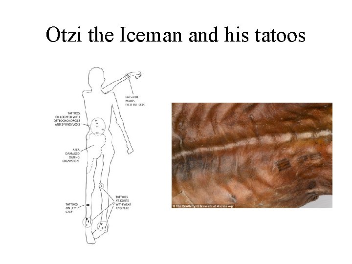 Otzi the Iceman and his tatoos 