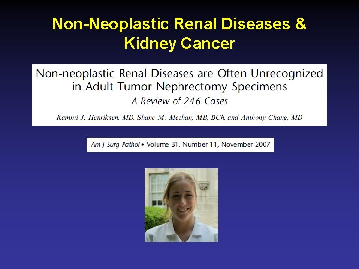 Non-Neoplastic Renal Diseases & Kidney Cancer 