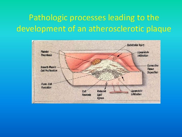 Pathologic processes leading to the development of an atherosclerotic plaque 