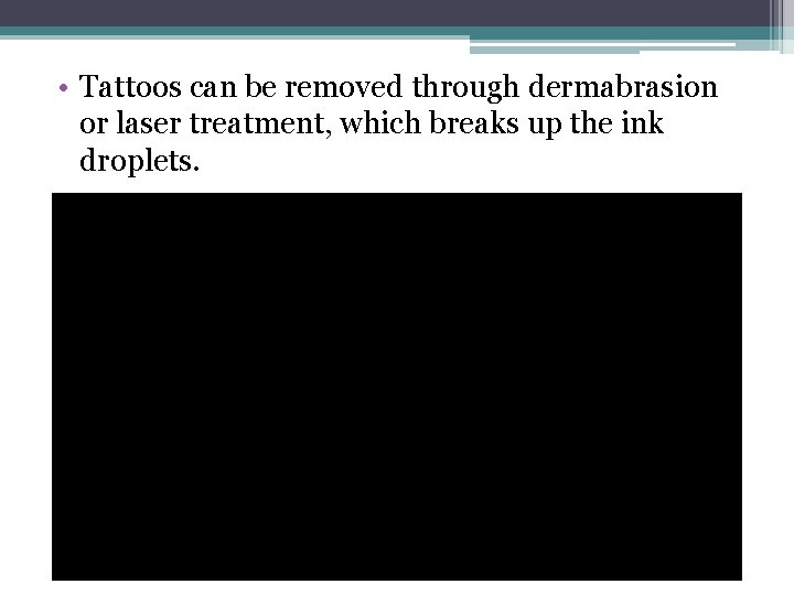  • Tattoos can be removed through dermabrasion or laser treatment, which breaks up