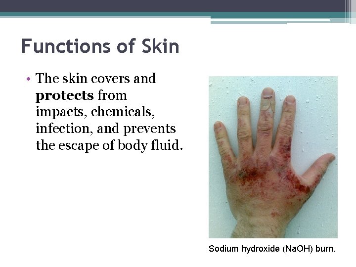Functions of Skin • The skin covers and protects from impacts, chemicals, infection, and