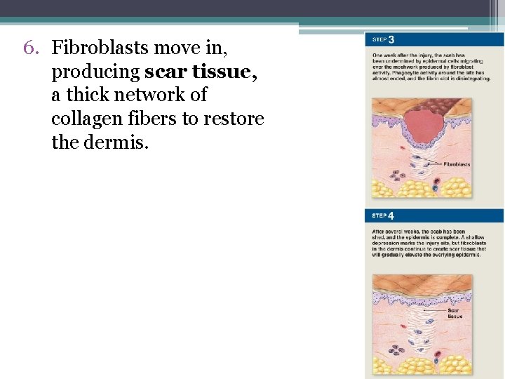 6. Fibroblasts move in, producing scar tissue, a thick network of collagen fibers to