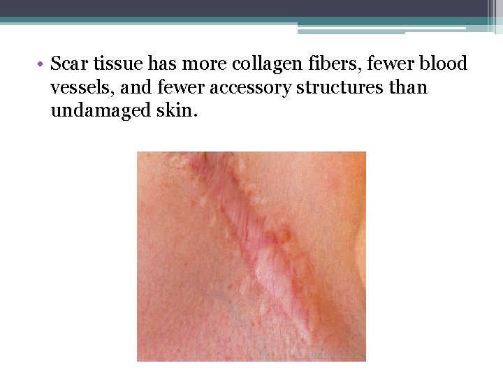  • Scar tissue has more collagen fibers, fewer blood vessels, and fewer accessory