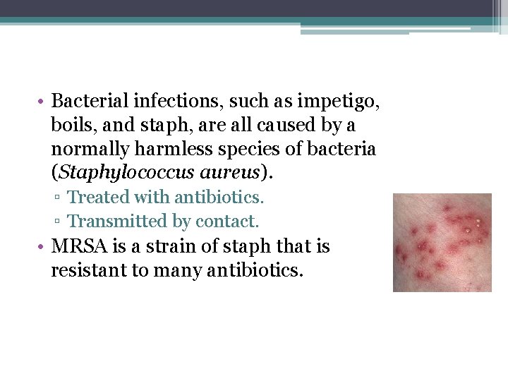  • Bacterial infections, such as impetigo, boils, and staph, are all caused by