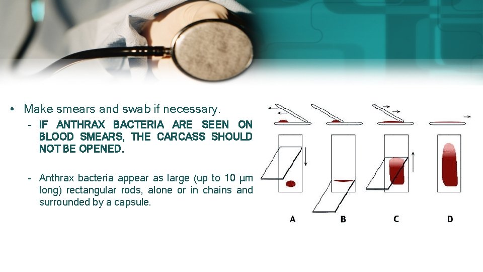 • Make smears and swab if necessary. – IF ANTHRAX BACTERIA ARE SEEN • Make smears and swab if necessary. – IF ANTHRAX BACTERIA ARE SEEN