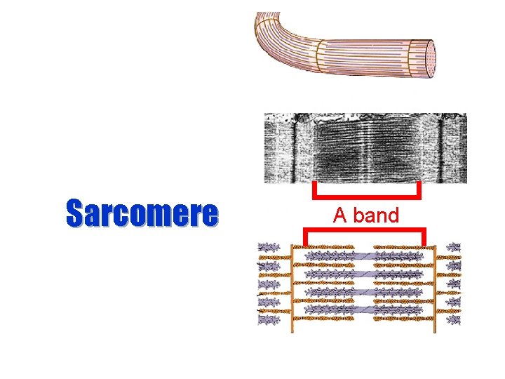 Sarcomere A band 