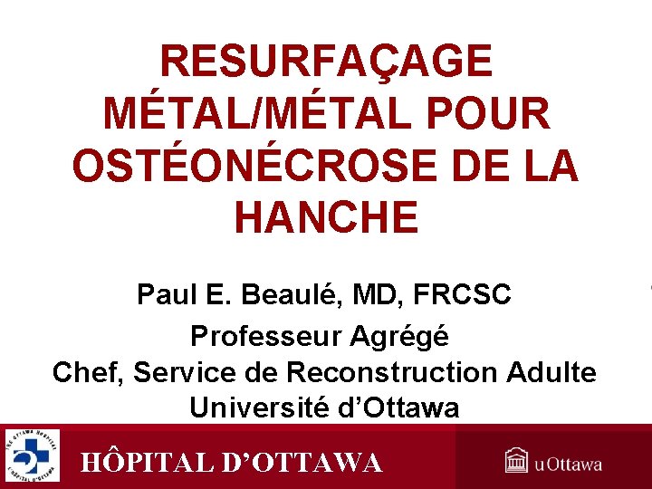 RESURFAÇAGE MÉTAL/MÉTAL POUR OSTÉONÉCROSE DE LA HANCHE Paul E. Beaulé, MD, FRCSC Professeur Agrégé RESURFAÇAGE MÉTAL/MÉTAL POUR OSTÉONÉCROSE DE LA HANCHE Paul E. Beaulé, MD, FRCSC Professeur Agrégé