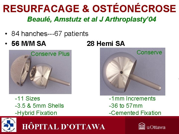 RESURFACAGE & OSTÉONÉCROSE Beaulé, Amstutz et al J Arthroplasty’ 04 • 84 hanches---67 patients RESURFACAGE & OSTÉONÉCROSE Beaulé, Amstutz et al J Arthroplasty’ 04 • 84 hanches---67 patients