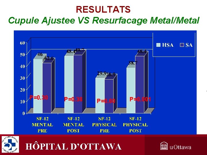 RESULTATS Cupule Ajustee VS Resurfacage Metal/Metal P=0. 30 P=0. 38 P=0. 60 HÔPITAL D’OTTAWA RESULTATS Cupule Ajustee VS Resurfacage Metal/Metal P=0. 30 P=0. 38 P=0. 60 HÔPITAL D’OTTAWA
