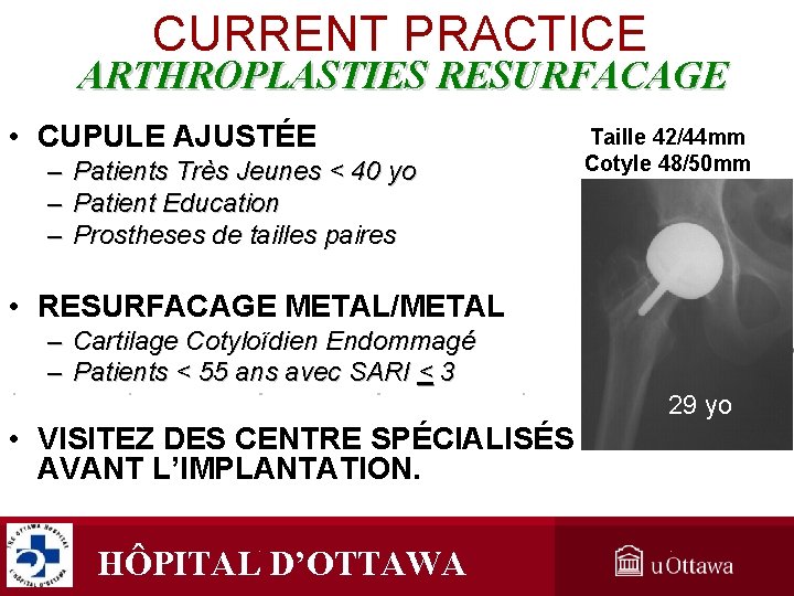 CURRENT PRACTICE ARTHROPLASTIES RESURFACAGE • CUPULE AJUSTÉE – – – Patients Très Jeunes < CURRENT PRACTICE ARTHROPLASTIES RESURFACAGE • CUPULE AJUSTÉE – – – Patients Très Jeunes <