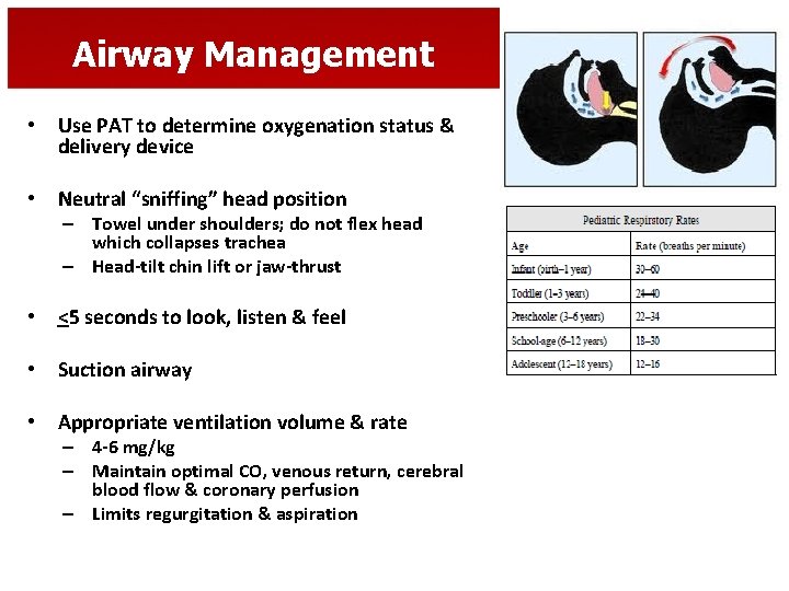 Airway Management • Use PAT to determine oxygenation status & delivery device • Neutral