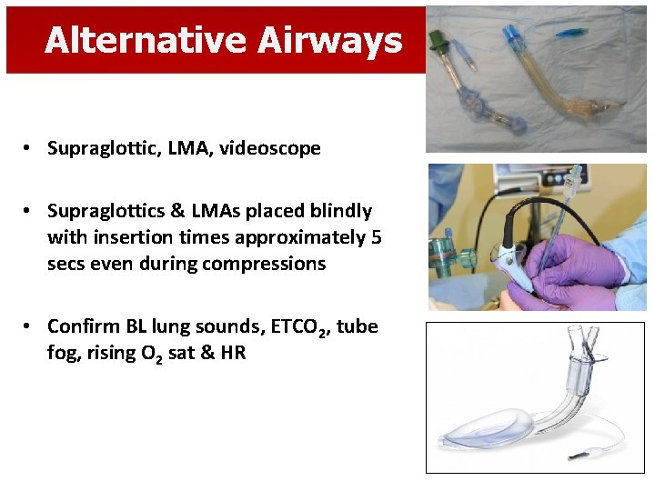 Alternative Airways • Supraglottic, LMA, videoscope • Supraglottics & LMAs placed blindly with insertion