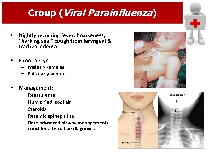 Croup (Viral Parainfluenza) • Nightly recurring fever, hoarseness, “barking seal” cough from laryngeal &
