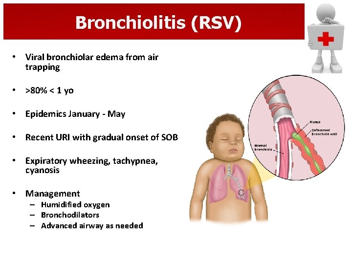 Bronchiolitis (RSV) • Viral bronchiolar edema from air trapping • >80% < 1 yo