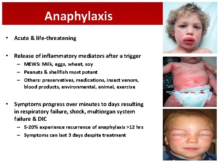 Anaphylaxis • Acute & life-threatening • Release of inflammatory mediators after a trigger –