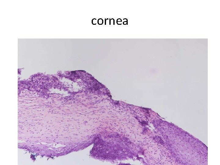 cornea 