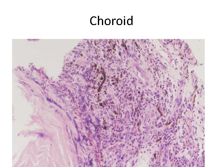Choroid 